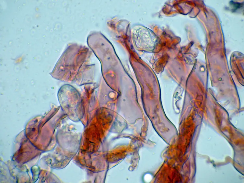 Aleurodiscus disciformis 10 - Cistidio-002